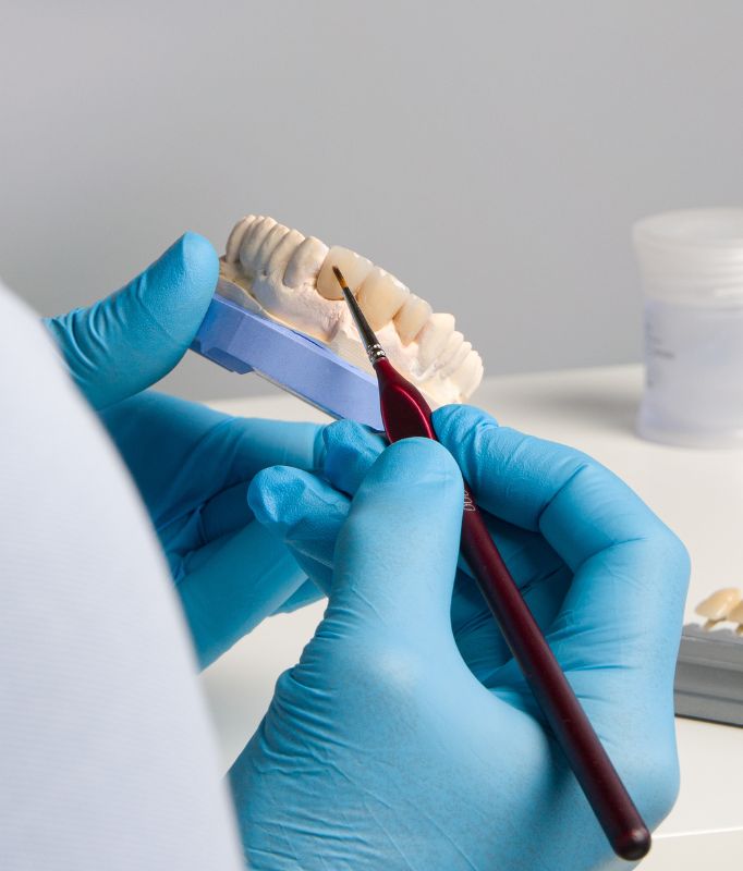 Dental Crowns Kilburn